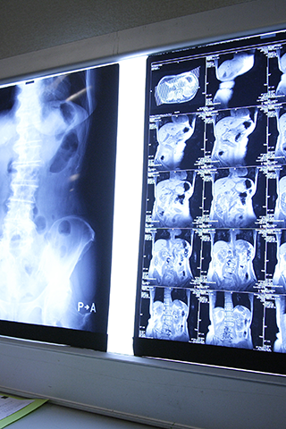 レントゲン（高画質・低線量）