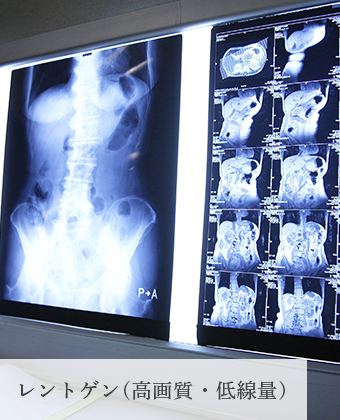 レントゲン